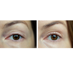iS Clinical C Eye Serum