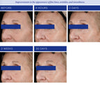 iS Clinical Youth Eye Complex